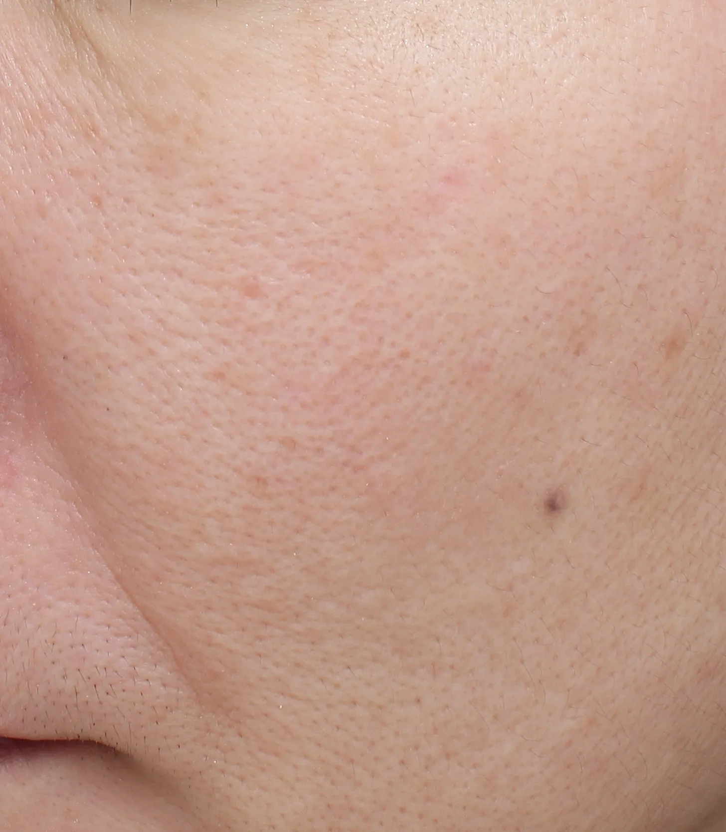 Naris Natural Skincare After